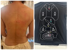 サロンドデュイ/1回施術/50 代/トーンヌール