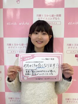 エクシアホワイトニング 大府店/お客様の口コミをご紹介☆