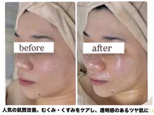 エムイーボーテ(me.Beaute)の雰囲気（美肌だけじゃない！フェイスラインもすっきり見えると好評です。）