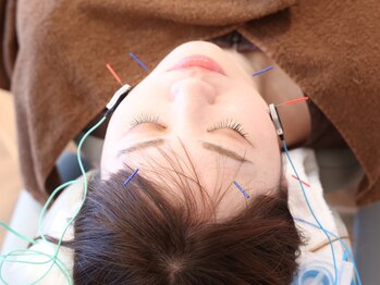 東天満鍼灸整体院/くいしばり・睡眠を整える