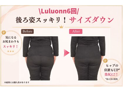 ヨサパーク ルアナ(YOSAPARK Luana)の写真