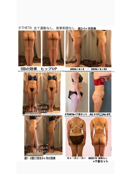 シエスタ(SIESTA)の写真/1ヶ月、2ヶ月、3ヶ月集中でダイエットと姿勢改善を両立！決めた人から理想を叶える、特別プランは必見★
