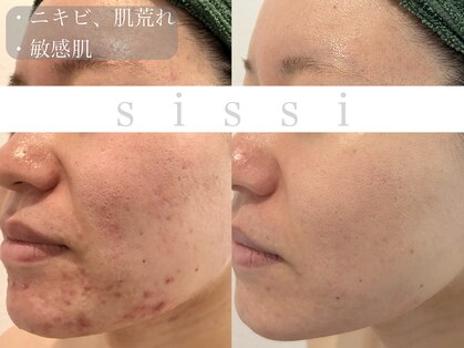 シシィ 二子玉川(sissi)の写真