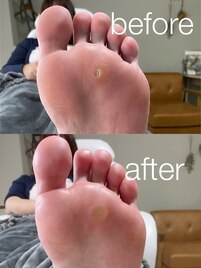 クイックケア☆