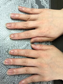 桃の木 吉祥寺店/40代【明るい手コース】before