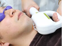 シュウ(Shuu)/【メンズ脱毛】ヒゲ脱毛