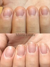 マリーロール 梅田店(Marie Laure)/自爪育成/深爪矯正/ネイルケア
