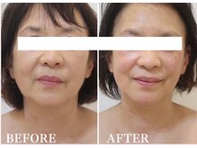 ドクターボディ 新宿店(Dr.Body)/【歪み/左右差/たるみ　60代】