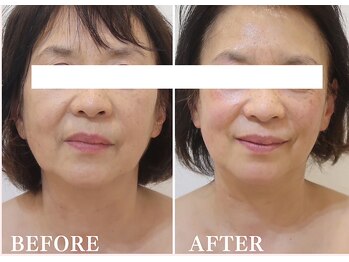 ドクターボディ 新宿店(Dr.Body)/【歪み/左右差/たるみ 60代】