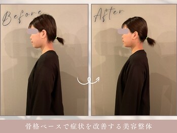 ほぐし屋 かすがい/猫背巻き肩矯正