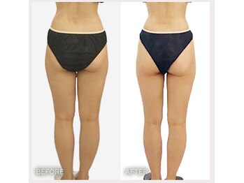 えすてさろん ケイアンドエフ(k&f)/脚が軽くなる度、心まで前向きに