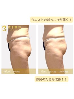 キングスサロン 熊本/脂肪燃焼され筋量UP♪