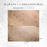 リュノン(Lunon.)