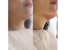 インディバサロン アンド(&.)の雰囲気（他店で効果のなかった方◎適切な施術でDTの不安を解消いたします）