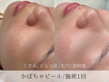 ミューズ バイ エス(MUSE BY S)/