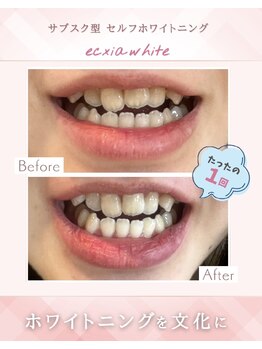 エクシアホワイト 立川南口店/店舗数日本一のホワイトニング