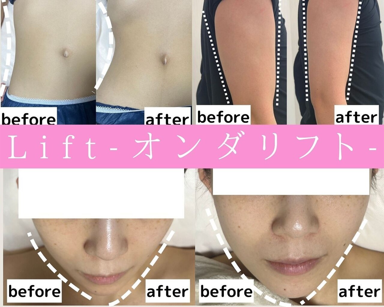 リフト 横浜(Lift)｜ホットペッパービューティー