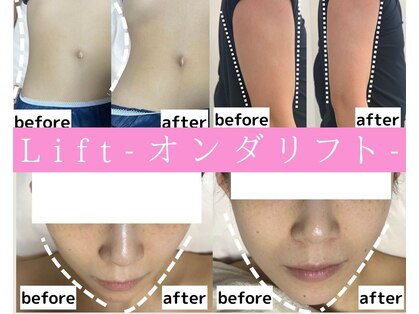 リフト 横浜(Lift)の写真