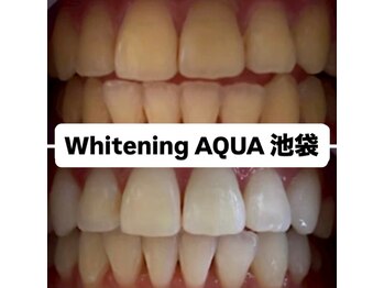 アクア 池袋店(AQUA)/ホワイトニング/池袋/東京/美白