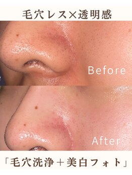 ウィッシュ 与野(Wish)の写真/毛穴・くすみ集中フェイシャル【春得50％OFFで¥9800】毛穴洗浄×コラーゲン美白フォトで透明感・ハリ実感！