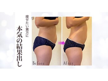 レヴェイユ/お客様Before→After