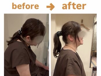 はり灸ソル(はり灸Sol)の写真/肩が凝りすぎて頭痛がする、首が痛くて眠れない、マッサージに行ってももたない、そんなあなたに。