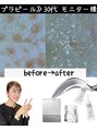 サロンスペース 新浦安店 毛穴/ニキビ改善/毛穴/ハーブピーリング/シミケア/美白/新浦安
