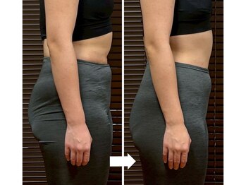 たけのこの写真/【全身ボディ☆30-40代の体型崩れに】骨格リセット痩身ボディメイク100分12000円
