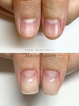 マリーロール 梅田店(Marie Laure)/自爪育成/深爪矯正/ネイルケア
