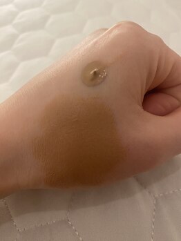 カランコエ(KALANCHOE)/ニキビケアもできて隠せる★