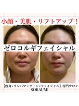 ソラウミ(SORAUMI)/小顔・美肌になりたい方はコレ！