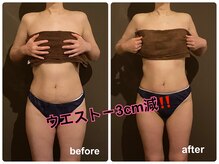 ラルゥ(Ralue)/MONNALI マット　痩身/リンパ