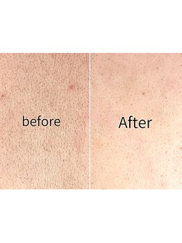 ブライダルメニューがあるサロン