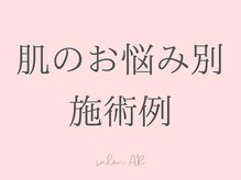 サロン アール(salon AR)/