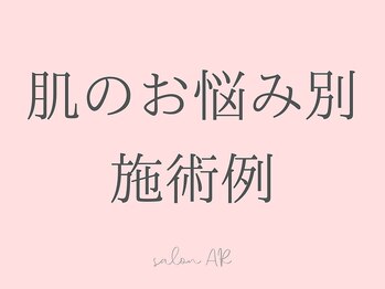 サロン アール(salon AR)/