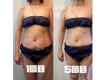 鍼灸整骨院ナガサキ(nagasaki)