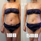 鍼灸整骨院ナガサキ(nagasaki)