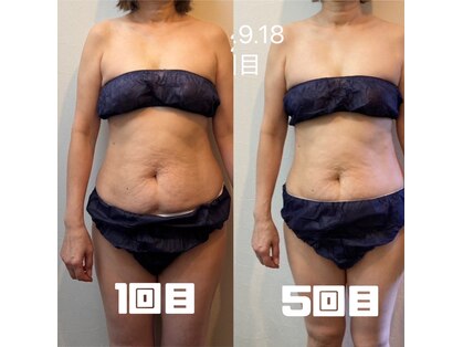 鍼灸整骨院ナガサキ(nagasaki)の写真