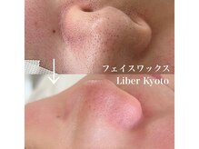 リベルキョウト 京都駅前店(Liber Kyoto)/フェイスワックス脱毛