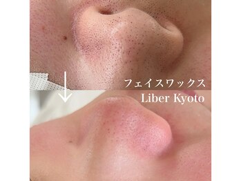 リベルキョウト 京都駅前店(Liber Kyoto)/フェイスワックス脱毛