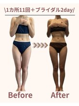 ハレアンド(Hare&)/ドレス映えする背中二の腕になる