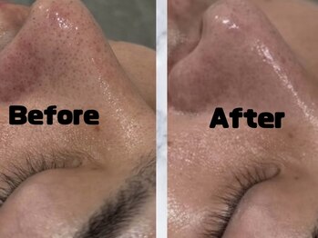 シード(SHE°)/陶肌トリートメント