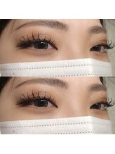 エテルニテ(eternite)/フラットラッシュ