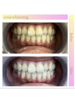 エクシア 伊勢店 サロンルナ/