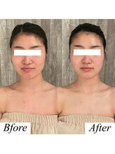 グレースフィオーレ 上野御徒町店(gracefiore)/ビフォーアフター