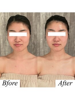 グレースフィオーレ 上野御徒町店(gracefiore)/ビフォーアフター