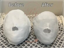 R-1ビューティーサロン 銀座/BEFORE＆AFTER