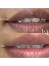 アリム(alim)/LEMELLA（ルメラ）before＆afte