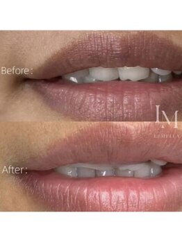 アリム(alim)/LEMELLA(ルメラ)before&afte