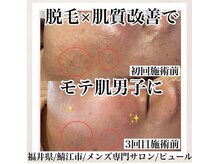 ピュール 鯖江店(PUR)/眉毛サロン/眉毛/メンズ脱毛